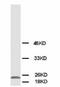 Phosphomevalonate Kinase antibody, LS-C171827, Lifespan Biosciences, Western Blot image 