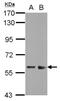 Zinc Finger And SCAN Domain Containing 32 antibody, NBP2-21016, Novus Biologicals, Western Blot image 