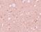 SEC14 And Spectrin Domain Containing 1 antibody, PA5-21009, Invitrogen Antibodies, Immunohistochemistry frozen image 