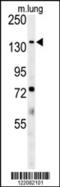 ATPase Phospholipid Transporting 11C antibody, MBS9203021, MyBioSource, Western Blot image 