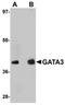 GATA Binding Protein 3 antibody, orb75358, Biorbyt, Western Blot image 