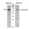 Cortactin antibody, LS-C387619, Lifespan Biosciences, Western Blot image 