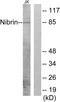 Nibrin antibody, LS-C118028, Lifespan Biosciences, Western Blot image 