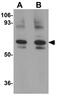 Golgi Membrane Protein 1 antibody, GTX31391, GeneTex, Western Blot image 