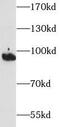 Integrin Subunit Beta 2 antibody, FNab09893, FineTest, Western Blot image 