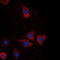 DEAD-Box Helicase 3 X-Linked antibody, LS-C358966, Lifespan Biosciences, Immunofluorescence image 