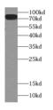 Carnitine Palmitoyltransferase 1C antibody, FNab01945, FineTest, Western Blot image 