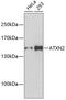 Ataxin 2 antibody, 19-934, ProSci, Western Blot image 