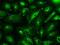 Glutamate Decarboxylase 1 antibody, MA5-24909, Invitrogen Antibodies, Immunocytochemistry image 