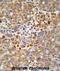 AlkB Homolog 3, Alpha-Ketoglutaratedependent Dioxygenase antibody, abx034060, Abbexa, Immunohistochemistry paraffin image 