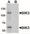 SIK Family Kinase 3 antibody, NBP2-41147, Novus Biologicals, Western Blot image 