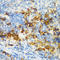 CD3d Molecule antibody, LS-C331376, Lifespan Biosciences, Immunohistochemistry paraffin image 