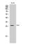 Empty Spiracles Homeobox 1 antibody, A06307-1, Boster Biological Technology, Western Blot image 