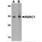 Arginine And Serine Rich Coiled-Coil 1 antibody, MBS150660, MyBioSource, Western Blot image 