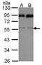 JNK1 + JNK2 antibody, PA5-28664, Invitrogen Antibodies, Western Blot image 