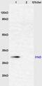 Alpha 2-HS Glycoprotein antibody, GTX60278, GeneTex, Western Blot image 