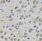 Transglutaminase 1 antibody, FNab08649, FineTest, Immunohistochemistry paraffin image 