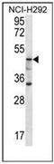 Glucosylceramidase Beta 3 (Gene/Pseudogene) antibody, AP51789PU-N, Origene, Western Blot image 