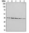 Arginase 2 antibody, LS-C351841, Lifespan Biosciences, Western Blot image 