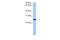 Centrosomal Protein 112 antibody, PA5-44139, Invitrogen Antibodies, Western Blot image 