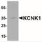 Potassium Two Pore Domain Channel Subfamily K Member 1 antibody, NBP2-41301, Novus Biologicals, Western Blot image 