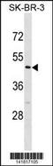 Calsequestrin-2 antibody, 60-785, ProSci, Western Blot image 