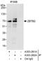 Zinc Finger And BTB Domain Containing 2 antibody, A303-261A, Bethyl Labs, Immunoprecipitation image 