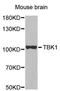 TANK Binding Kinase 1 antibody, A2573, ABclonal Technology, Western Blot image 