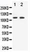 ETK2 antibody, PA1569, Boster Biological Technology, Western Blot image 