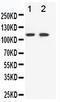 EPH Receptor B3 antibody, PA1569, Boster Biological Technology, Western Blot image 