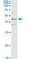 Keratin 17 antibody, LS-B6108, Lifespan Biosciences, Immunoprecipitation image 