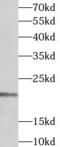 Mitochondrial import inner membrane translocase subunit Tim17-A antibody, FNab08697, FineTest, Western Blot image 