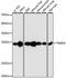 Transmembrane P24 Trafficking Protein 9 antibody, GTX66425, GeneTex, Western Blot image 