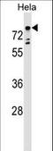 T-box transcription factor TBX2 antibody, LS-C157152, Lifespan Biosciences, Western Blot image 