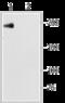 Sodium Voltage-Gated Channel Alpha Subunit 5 antibody, GTX54803, GeneTex, Western Blot image 
