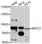 TFIIH basal transcription factor complex helicase XPD subunit antibody, MBS127977, MyBioSource, Western Blot image 