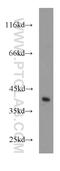 Cyclin Dependent Kinase 3 antibody, 55103-1-AP, Proteintech Group, Western Blot image 