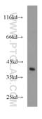 Cyclin-dependent kinase 3 antibody, 55103-1-AP, Proteintech Group, Western Blot image 