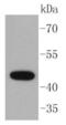 Keratin 15 antibody, NBP2-67525, Novus Biologicals, Western Blot image 