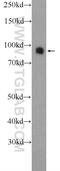 Dishevelled Segment Polarity Protein 2 antibody, 12037-1-AP, Proteintech Group, Western Blot image 