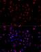 Voltage Dependent Anion Channel 1 antibody, LS-C748679, Lifespan Biosciences, Immunofluorescence image 