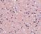 Stathmin 1 antibody, GTX31760, GeneTex, Immunohistochemistry paraffin image 