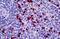 Hepatocyte Growth Factor-Regulated Tyrosine Kinase Substrate antibody, orb94866, Biorbyt, Immunohistochemistry paraffin image 