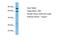 Integrin Subunit Beta 5 antibody, A30133, Boster Biological Technology, Western Blot image 