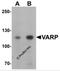 Ankyrin Repeat Domain 27 antibody, 6673, ProSci, Western Blot image 