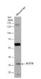 Acyl-coenzyme A thioesterase 8 antibody, NBP1-32452, Novus Biologicals, Western Blot image 