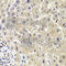 AKT1 Substrate 1 antibody, A6238, ABclonal Technology, Immunohistochemistry paraffin image 