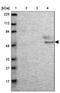 mTERF domain-containing protein 3, mitochondrial antibody, NBP1-82241, Novus Biologicals, Western Blot image 