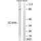 Zinc Finger CCCH-Type Containing 8 antibody, PA5-50166, Invitrogen Antibodies, Western Blot image 
