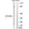 Zinc Finger CCCH-Type Containing 8 antibody, PA5-50166, Invitrogen Antibodies, Western Blot image 